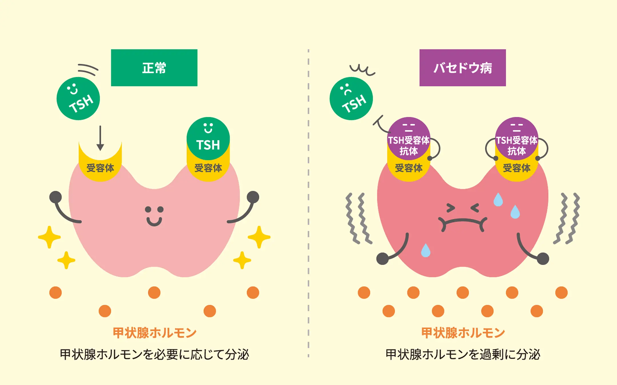 正常な甲状腺とバセドウ病の違いを比較した図。左は正常で、TSHが受容体に作用し、甲状腺ホルモンを必要に応じて分泌。右はバセドウ病で、TSH受容体抗体が受容体を刺激し、甲状腺ホルモンを過剰に分泌している様子を示す。